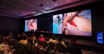 Transmissão de Eventos